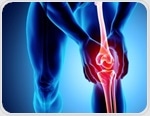 Injectable fatty acid copolymer ARA 3000 BETA shows therapeutic potential in treating osteoarthritis