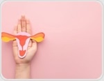 Passing on Polycystic Ovary Syndrome: Health risks for Male offspring of Women with PCOS