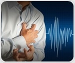 Mental disorders in adults aged 20–39 years linked to elevated risk of heart attack and stroke