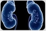 New tests based on biomarkers may improve diagnosis and treatment of acute kidney injury