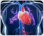 Kentucky, Michigan scientists receive American Heart Association Merit Award for cardiovascular research