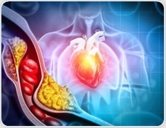 Study reveals type 2 diabetes diagnosis spurs cholesterol shifts, alters cardiovascular risk