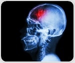 New blood biomarkers can help quantify the brain impact of neurosurgery