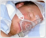 Study explores the link between sleep apnea and brain volume