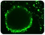 Location-dependent gene expression in ovarian cancer: Insights from 3-D models