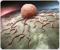 3D models of ovarian cancer reveal how cell’s location can affect tumor biology