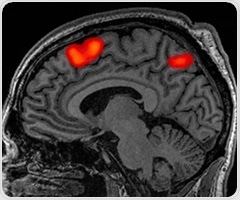 Researchers develop new way to detect brain changes associated with schizophrenia