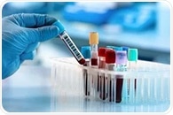 The critical role of flow cytometry in CAR+ T-Cell trials