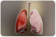 What Are the Symptoms of Empyema?