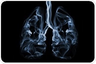 Study aims to identify interventions to combat stigma associated with lung cancer and smoking-related respiratory diseases