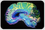 Study identifies a molecule that may be behind COVID-19 brain fog
