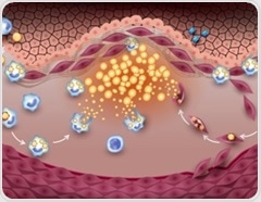 New study reveals alarming cardiovascular risks from COVID