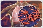 Fighting tuberculosis: Breakthrough analysis reveals mixed strain infections