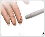 Gut bacteria play major role in diabetes, obesity depending on host’s genetic makeup