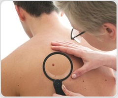 Desmoplasmic melanoma may possess unprecedented burden of gene mutations, say UCSF scientists