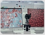 Revolutionizing Peptide Sequencing with Machine Learning for Personalized Medicine