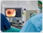 AI transforms colonoscopy: Boosting detection rates, slashing miss rates in cancer screening