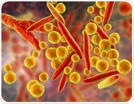 Netherlands sees unexpected surge in Mycoplasma pneumoniae cases, younger population more affected