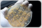 Study Investigates Antibiotic Resistance Genes Transfer Between Bacteria