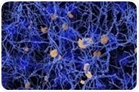 Experts join forces to define recommendations for biomarker-based diagnosis of Alzheimer’s disease