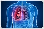 Advanced laser imaging illuminates molecular interactions driving lung cancer growth