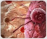Revolutionary therapeutic shows promise for pancreatic cancer treatment