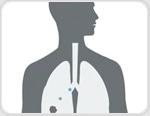 What disease areas can benefit from breath analysis?