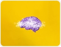 Physical activity and positive affect boost cognition in women with fibromyalgia despite pain