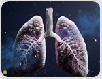Incidence and risk factors of an invasive fungal lung infection among COVID-19 patients