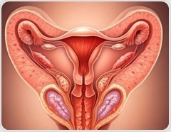 Understanding cardiovascular risks in endometriosis patients