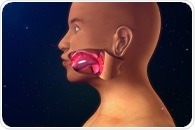 Single treatment with CRISPR gene editing  therapy offers hope for hereditary angioedema patients