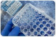 Advancing Neuroscience: The Critical Role of High-Quality Antibodies in Neurodegenerative Research