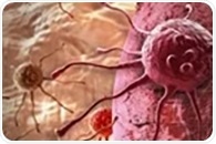Unveiling IRF1's Influence on Cancer Progression and Treatment Using Histology and Flow Cytometry