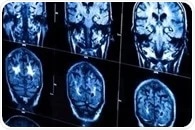 SWIR fluorescence imaging enhances visualization of lymphatic vessels