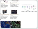 Uncovering novel therapeutic targets in immune checkpoint inhibitor resistance through spatial proteomics in metastatic tumor microenvironments