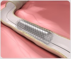 Artificial cilia system monitors mucus conditions in human airways