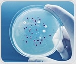 Symbiotic Bacteria Accompany Single-Celled Protists in the Ocean's Upper Layer
