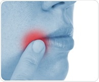Herpes infection through the nose can lead to anxiety, motor impairment and cognitive deficits