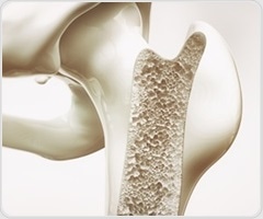 Study links inflammation pathways to changes in bone mineral density