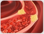 One shot to lower cholesterol for life? Scientists unlock a groundbreaking gene therapy