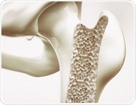 Can yogurt and kefir help prevent osteoporosis? Scientists examine the facts