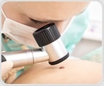 Serum hsa_circ_101555 as a promising biomarker for hepatocellular carcinoma