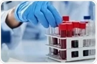 New Blood Test Could Revolutionize Alzheimer’s Diagnosis