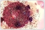Immune resilience identified as key to healthy aging and longevity
