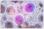 Novel cancer immunotherapy approach could complement existing CAR-T treatments