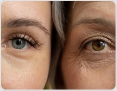 Can your diet slow skin aging? New review reveals what helps and what harms