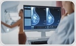 AI Could Enhance Interval Breast Cancer Detection