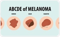 New AI Model Sets Benchmark in Skin Cancer Detection with 99.8% Accuracy