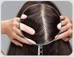 Scalp Microbiome Explained: What’s Living on Your Scalp and Why It Matters
