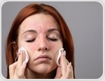 Why skin shame matters more than symptoms in chronic skin conditions